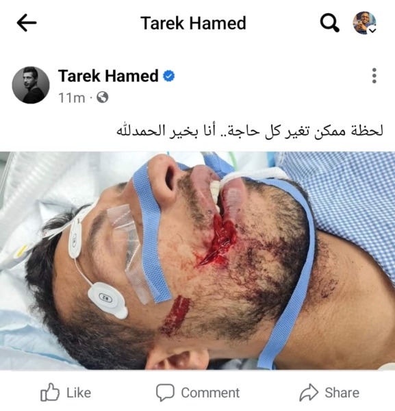 أول تعليق من طارق حامد بعد الإصابة التي تعرض لها .. و يفاجئ الجماهير بصورة غير متوقعة