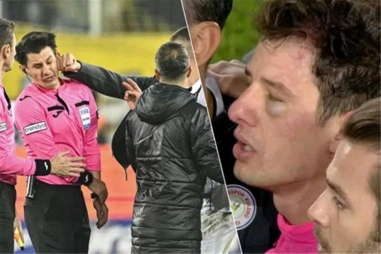 تعرض للضرب في الملعب وأدار مواجهات كبرى في أوروبا.. من هو خليل أوموت حكم قمة الزمالك والأهلي في السوبر المصري؟ 1 تعرض للضرب في الملعب وأدار مواجهات كبرى في أوروبا.. من هو خليل أوموت حكم قمة الزمالك والأهلي في السوبر المصري؟