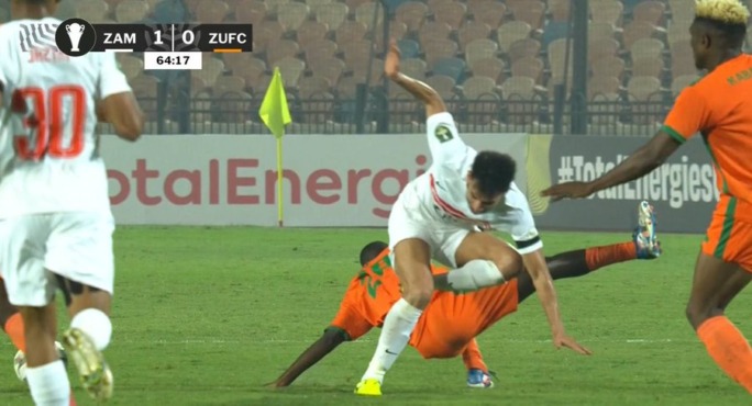 الكشف عن التشخيص المبدئي لإصابة دونجا أمام زيسكو