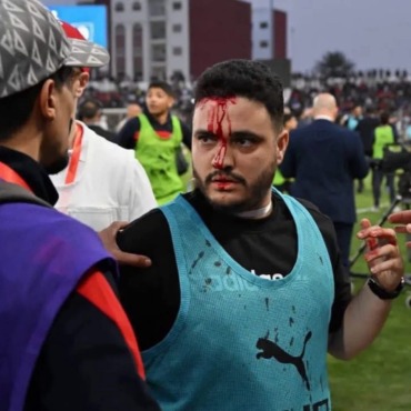 فوضى جماهيرية تؤجل انطلاق مواجهة أولمبيك آسفي واتحاد العاصمة في نصف نهائي الكونفدرالية- صورة